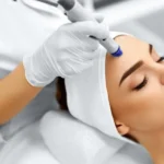 Procell Microneedling