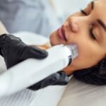 Microneedle Cosmetology