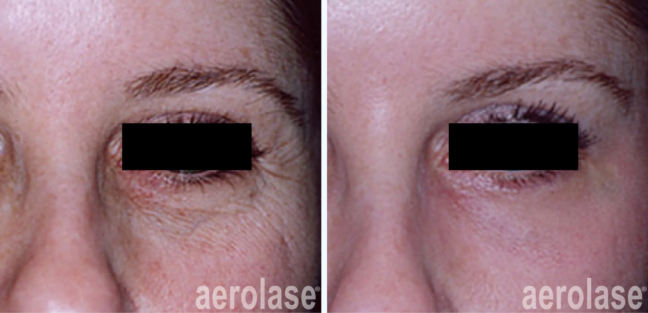 Anti Ageing Skin Care Treatment