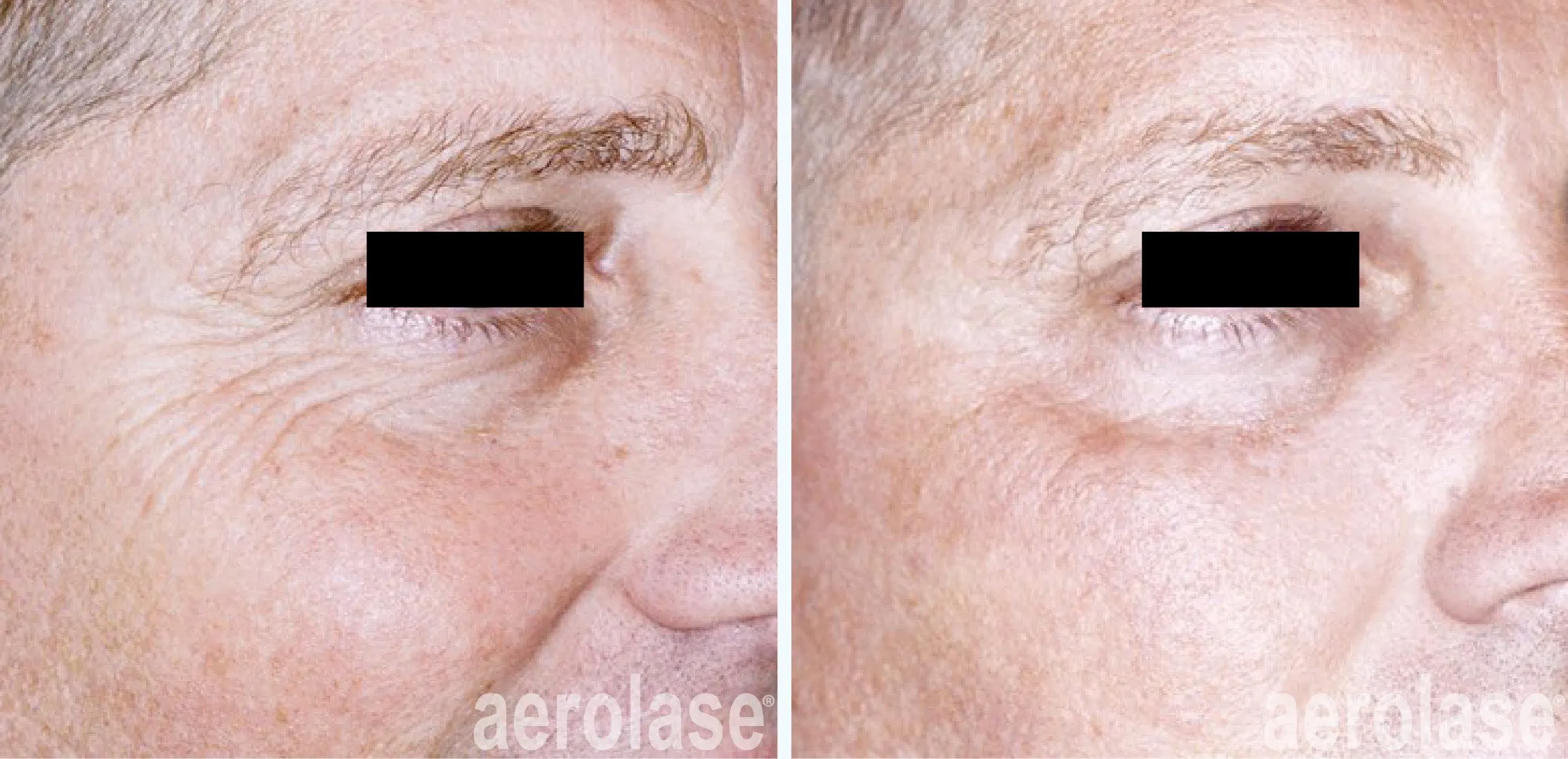 Skin Rejuvenation Treatments