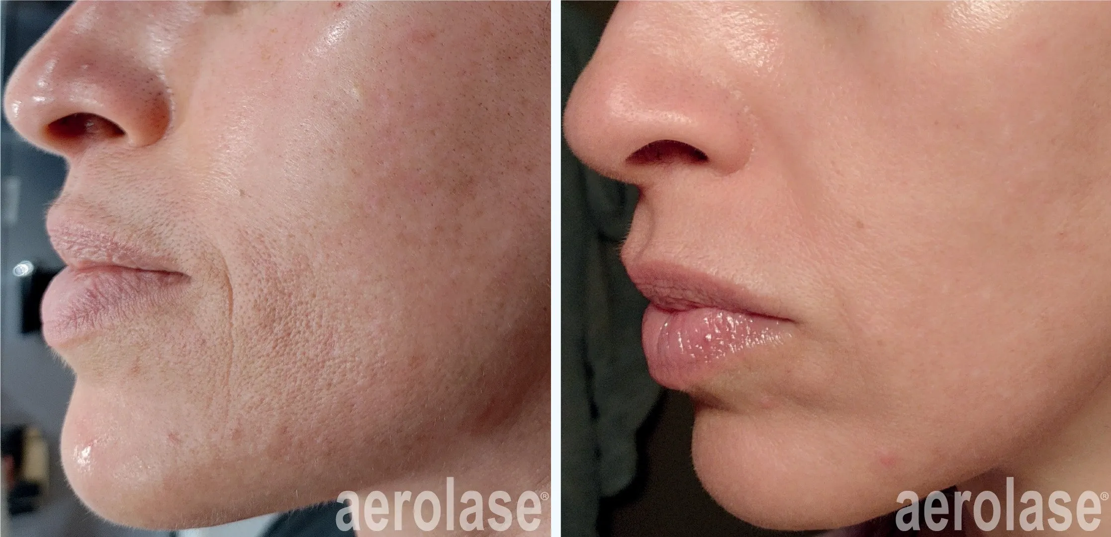 Skin healing and hydration therapy