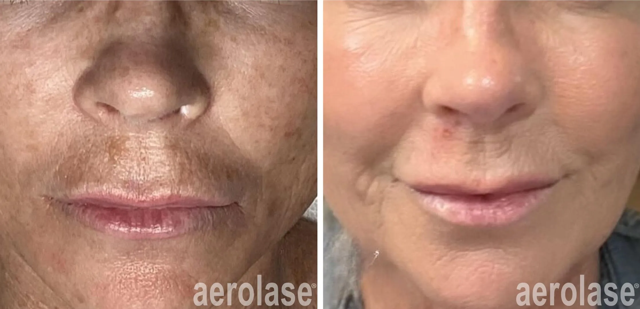treatment for anti ageing