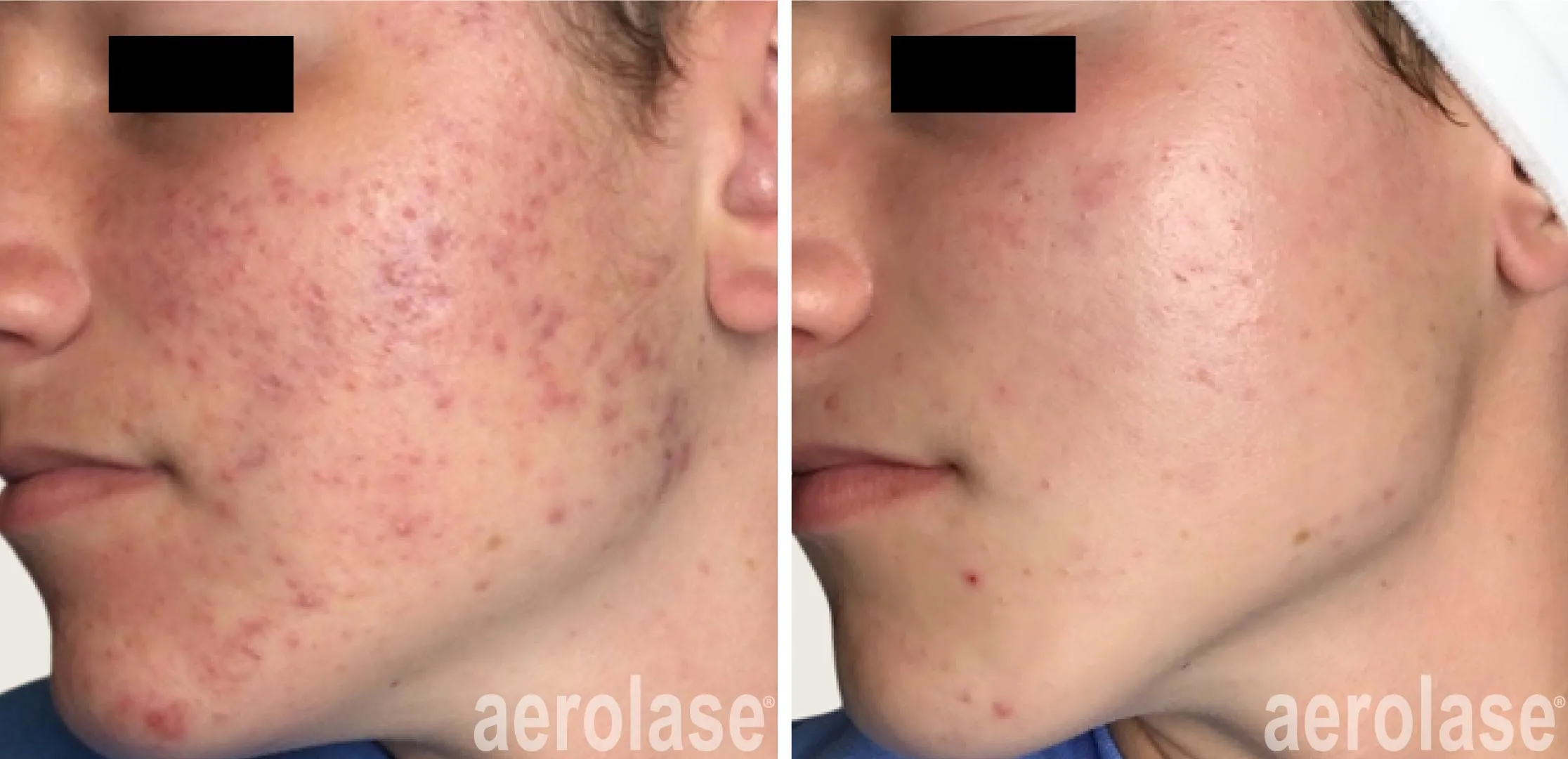 Stimulates Collagen to Prevent & Repair Scarring