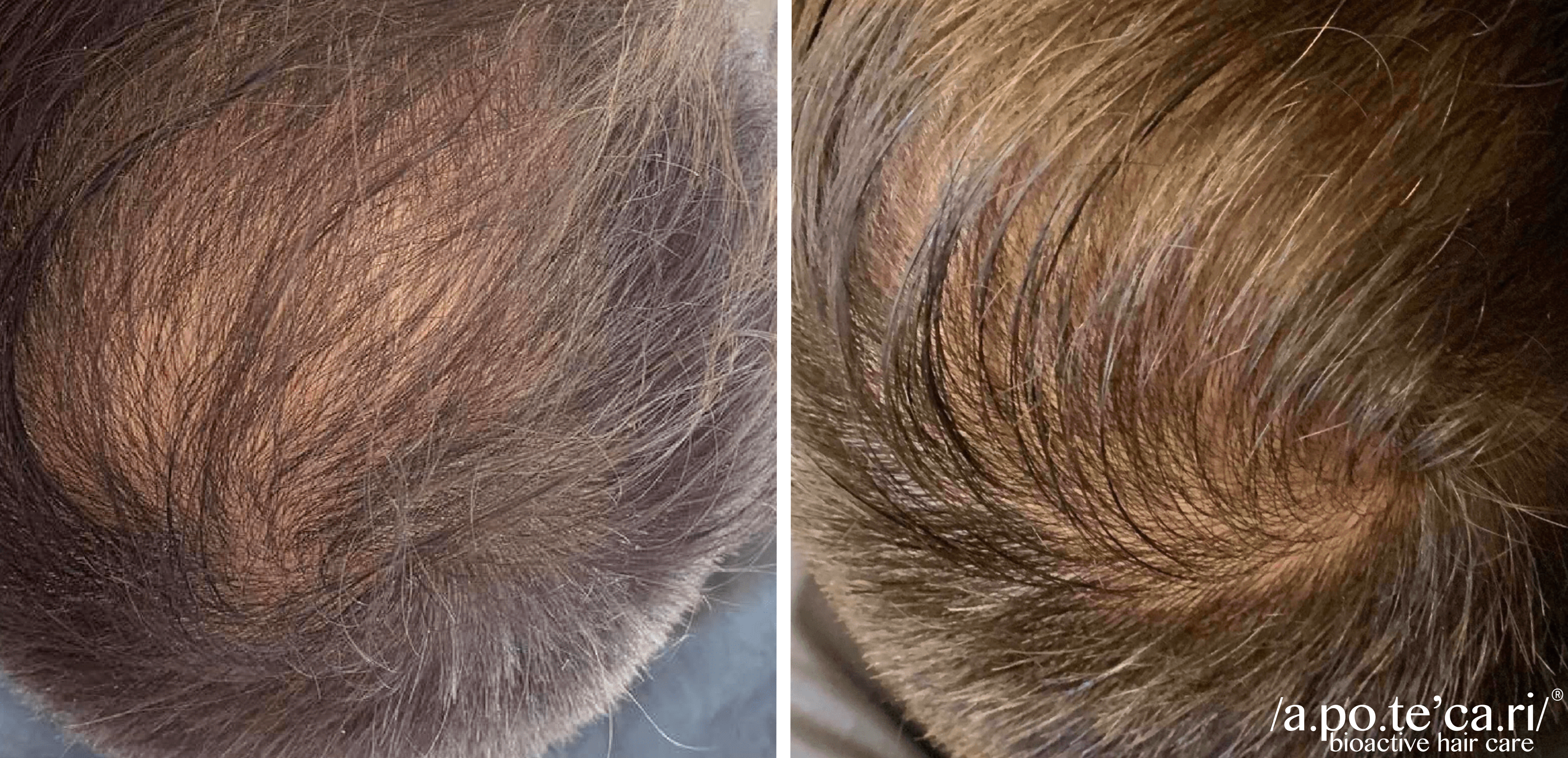 Hair Treatment​