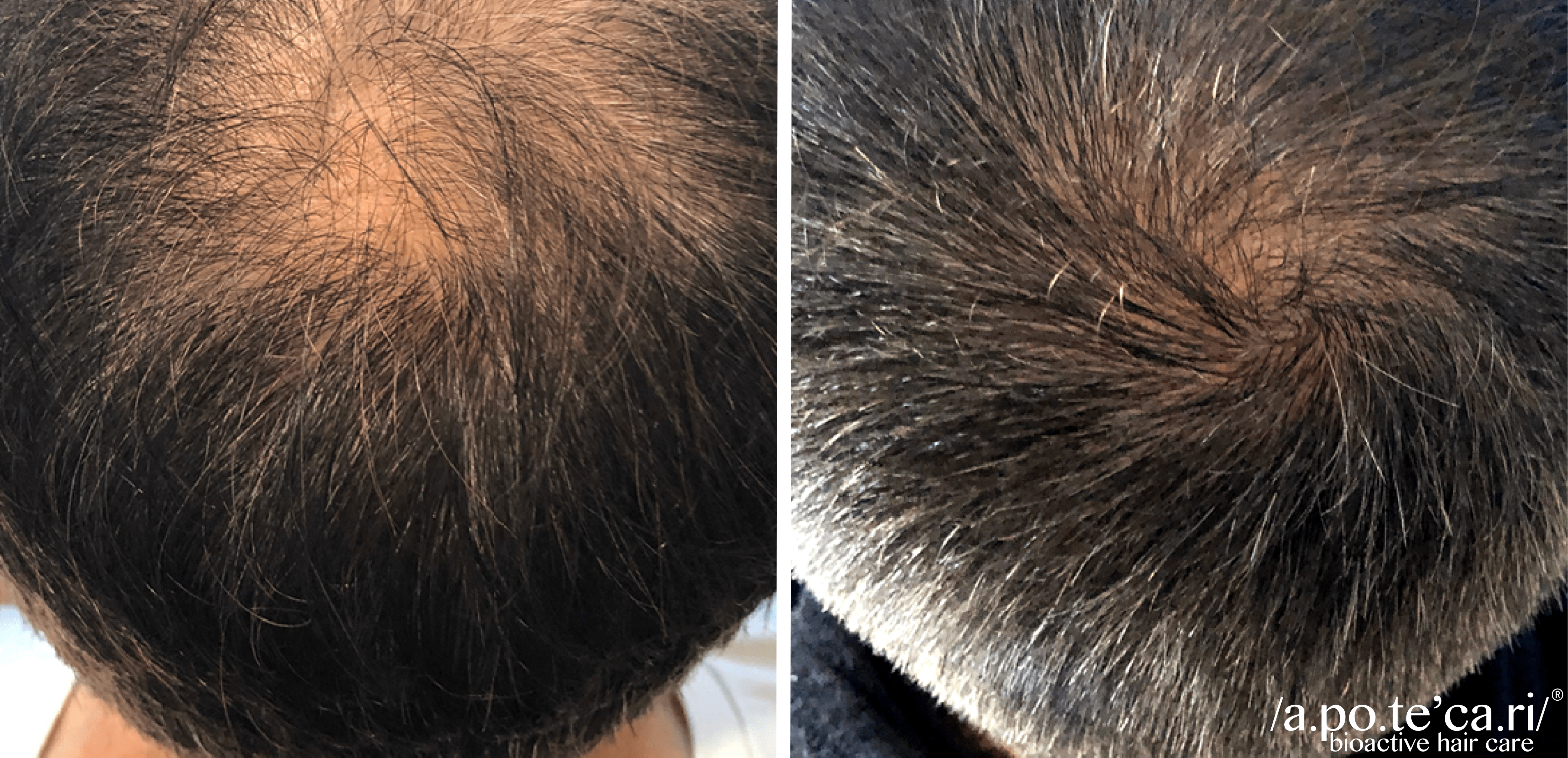 Hair Loss Treatment​