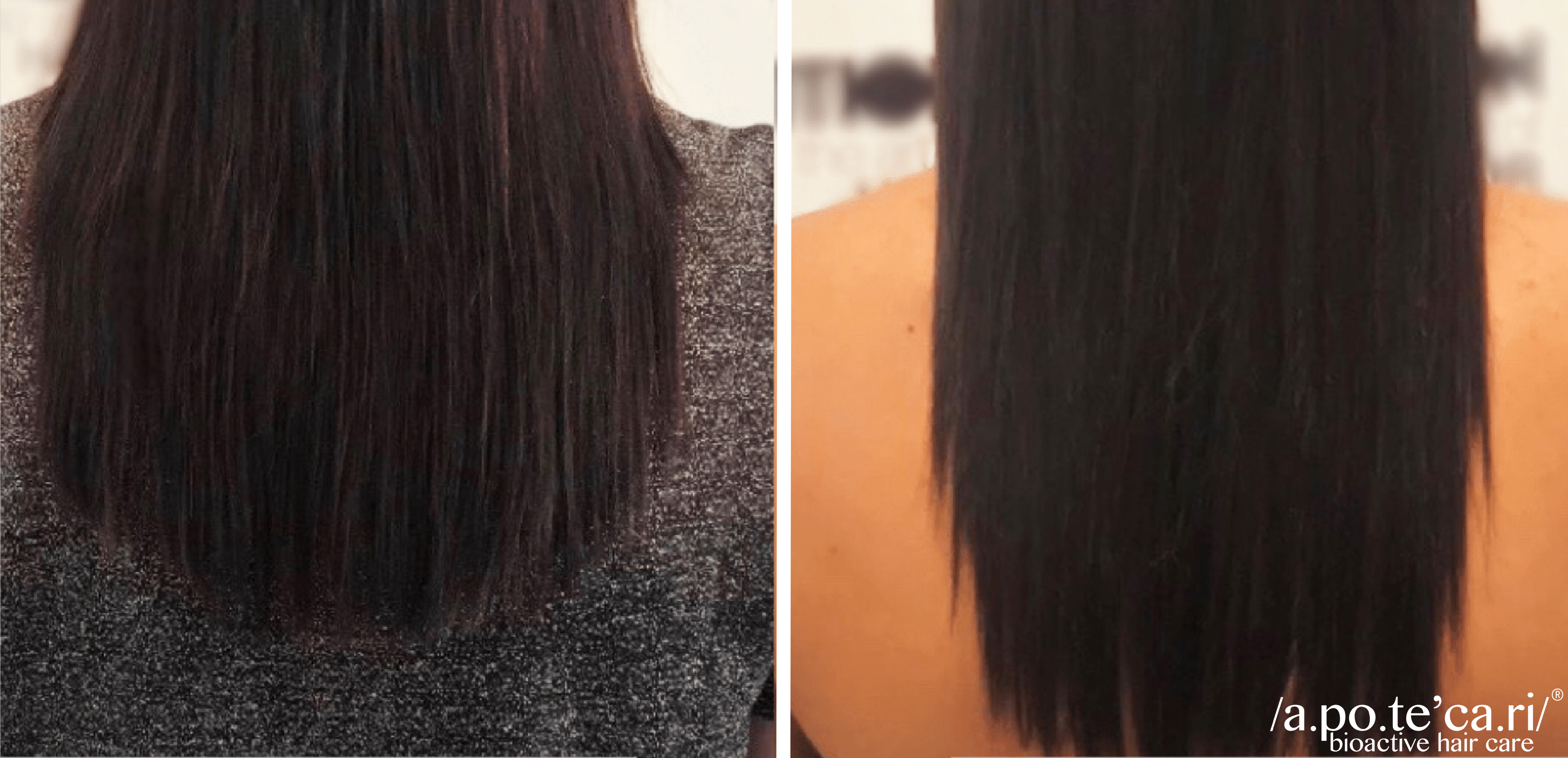 Hair Growth Treatment