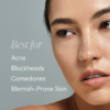 Cleansing Gel with Salicylic Acid - Image 4