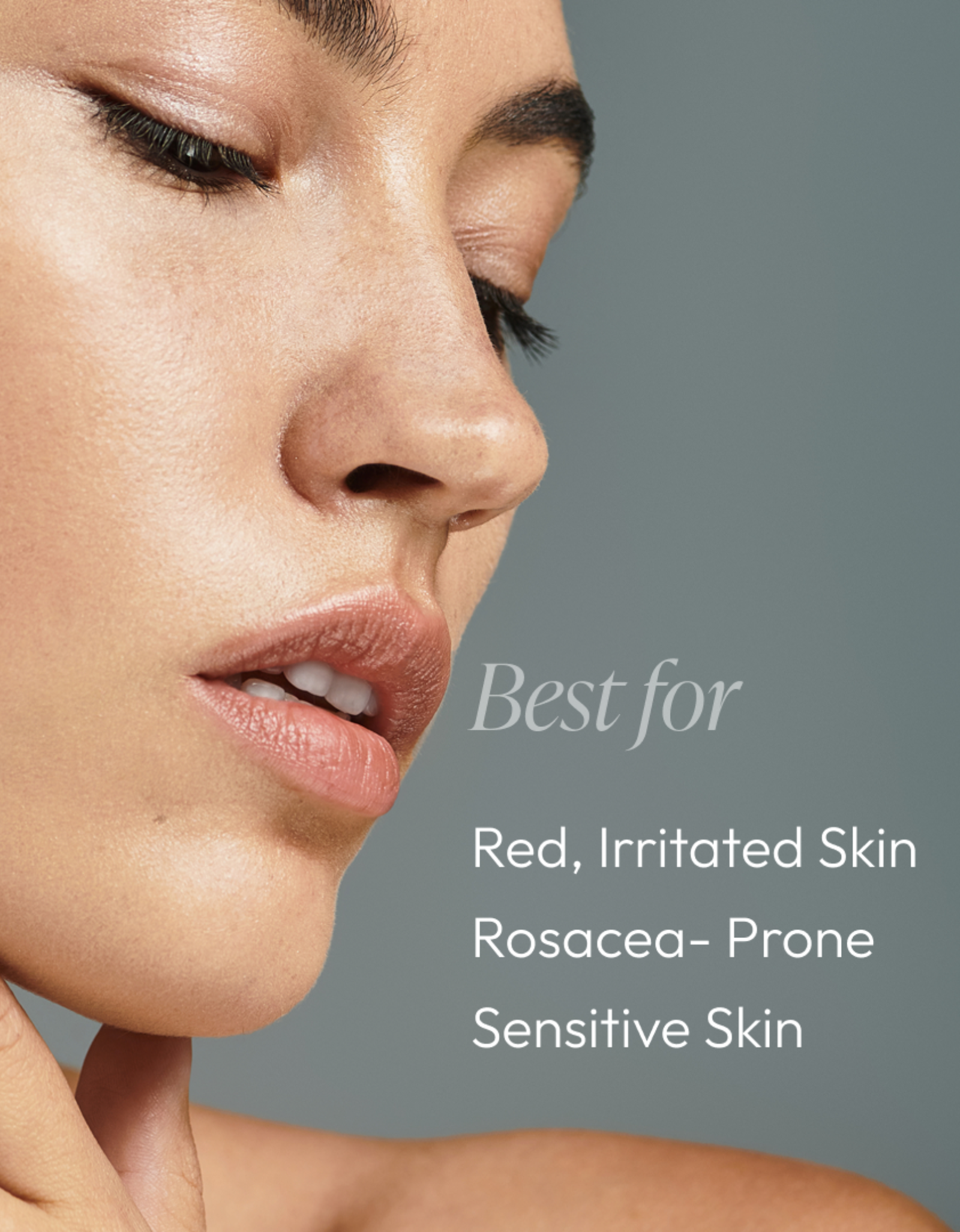 Rose-Ease Relief Cream - Image 5