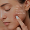 Essential Acne Kit - Image 11