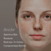 Essential Sensitive Kit - Image 11